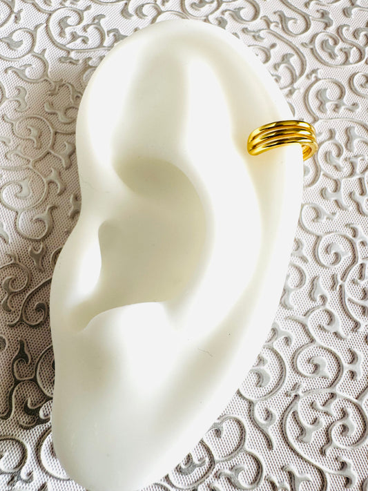 Arete De Cartilago